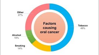 VIZILITE vs VELSCOPEOral cancer Detection [upl. by Dunkin]