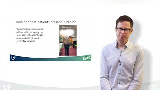 How patients with MASSIVE IRREPARABLE ROTATOR CUFF TEARS presents  Eoin Ó Conaire on Trust MeEd [upl. by Amitaf568]