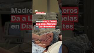 Madre con 2 úteros da a luz a gemelas en días diferentes  N ciencia salud [upl. by Eniretac]