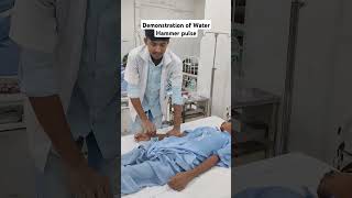 Demonstration of Water Hammer Pulse  In Aortic Regurgitation medical medicine doctor [upl. by Diane]