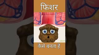 fissure treatment at home hindi shortvideo viral viralvideo [upl. by Norine]