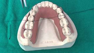 Peridontal Suturing Techniques [upl. by Sobel]