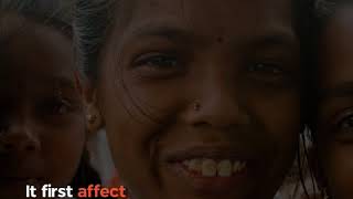 Why children in this Dhanbad village dont smile [upl. by Ahsinra]