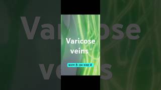 Varicose veinsmedicine healthtipshealth healthcaresymptoms treatmentvaricosevein [upl. by Jeffy46]