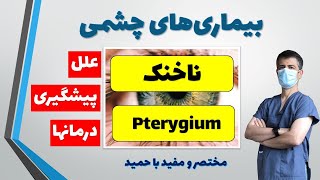 علل، راههای پیشگیری و درمان ناخنک، تفاوت با پینگوکولا Pterygium surfers eye vs Pinguecula [upl. by Attelrahc]