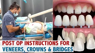 Post Op Instructions for Veneers Crowns amp Bridges [upl. by Adaven]