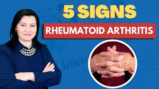 5 Signs of Rheumatoid Arthritis That You Should Not Ignore [upl. by Cyril624]