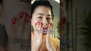 Stop washing your face if you have acne read the description [upl. by Nalahs]