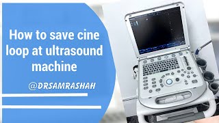 How to save cine loop image at mindray ultrasound machine [upl. by Yttisahc]