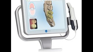 IDS 2017 Intraoral Scanners Review  iTero [upl. by Welby182]