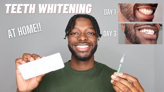 MY TEETH WHITENING ROUTINE AT HOME  OPALESCENCE TEETH WHITENING [upl. by Toblat255]