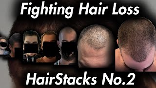 Reversing Hair Loss and Fixing Mental Health HairStacks No2 [upl. by Assenar]