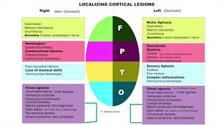 Localising cortical lesions for medical students [upl. by Onifur]