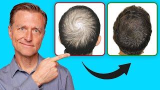 How to Help Regrow Your Hair UPDATED VITAL INFO [upl. by Ynaitirb]