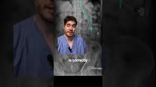 Abdominal Xray Mnemonic TOOB Full Video in description 🔽 [upl. by Meeks]