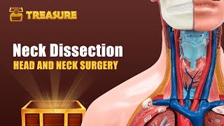 Neck Dissection Explained  PrepLadder NEET SS [upl. by Deach295]