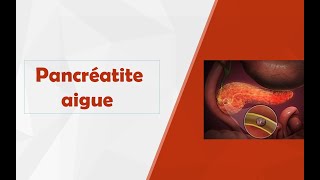 Pancréatite aigue [upl. by Kcirderfla]