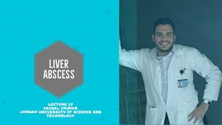 LIVER ABSCESS  PYOGENIC amp AMEBIC LIVER ABSCESS APPROACH AND TREATMENT شرح خراج الكبد لطلبه الطب [upl. by Dasteel408]