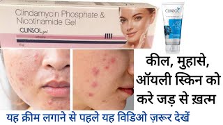 Clinsol Gel Cream  पिम्पल को करे जड़ से ख़त्म [upl. by Marilla523]