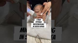 My take on potenza microneedling at lienjang clinic in SouthKorea to fade acnescars [upl. by Elihu670]