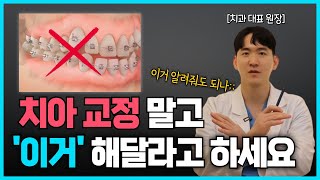 치아 교정 부작용 이거는 꼭 알고 하세요 ㅣ치아교정 과정 및 상식 좋은 치과 고르는 법 [upl. by Smeaj]