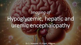 Imaging of ToxicMetabolic Brain Disorders hypoglycemic hepatic amp uremic encephalopathy [upl. by Ekalb]