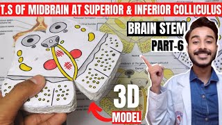 transverse section of midbrain at level of superior colliculus and inferior colliculus [upl. by David292]