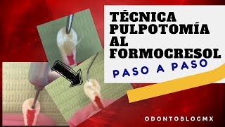 Técnica PULPOTOMÍA AL FORMOCRESOL  paso a paso [upl. by Gawlas533]