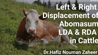 Displacement of AbomasumLDARDATreatment protocolComplete Lecture By Dr Hafiz Nouman Zaheer [upl. by Aivatco]