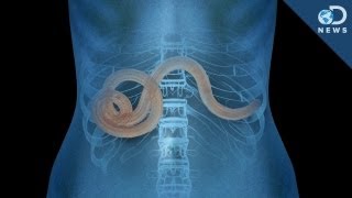 Why Parasites May Not Be All That Bad [upl. by Bernarr543]