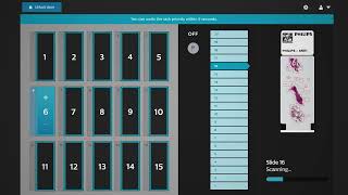 Digital pathology PIPS 5 solution video [upl. by Sakmar262]