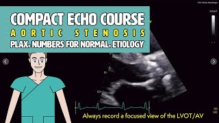 〖Echocardiography〗 Aortic stenosis  principles normal values amp the LVOT 🫀 [upl. by Powder865]