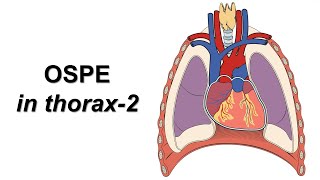 OSPE in thorax part2 Prof Dr Md Ashfaqur Rahman [upl. by Enileqcaj169]