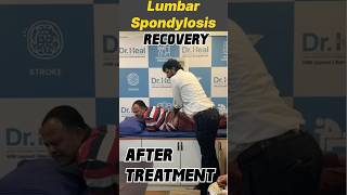 Lumbar Spondylosis Recovery After Treatment motivation yt ytshorts doctor [upl. by Ahtael]