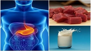 Foods to Avoid if You Have a Stomach Ulcer [upl. by Yeblehs317]