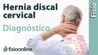 Cómo saber si tienes una hernia discal cervical [upl. by Elleb730]