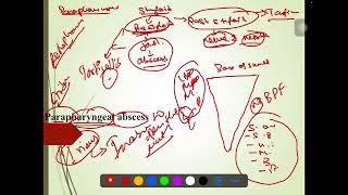 Parapharyngeal abscess [upl. by Dav116]