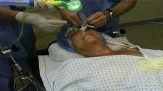 Fiberoptic Intubation [upl. by Anitac]