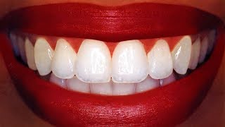 Teeth Whitening At Home In 3 Minutes  How To Whiten Your Yellow Teeth Naturally  100 Effective [upl. by Etat609]