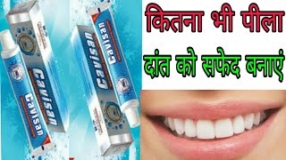 अपने पीले दांतो के सिर्फ 2 दिन में उजला करे  cavisan toothpaste full review in Hindi [upl. by Ahsilak558]