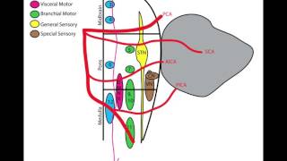 Lateral Medullary Wallenberg Syndrome [upl. by Drofiar691]