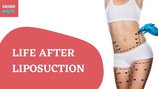 Life after Liposuction [upl. by Paluas]