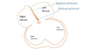 interatrial Septum development [upl. by Yecnay]