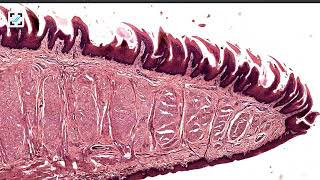 Histology of tongue filiform and fungiform papillae [upl. by Ocirderf]