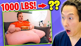 Plastic Surgeon Reacts to MY 600 LB LIFE She went from 1000 lbs to [upl. by Sawyor]