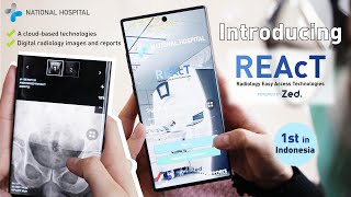 INTRODUCING REAcT The First Digital Radiology Images in Indonesia [upl. by Ainahtan]