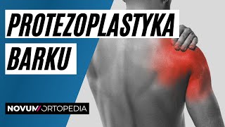 Protezoplastyka stawu barkowego  Novum Ortopedia [upl. by Lud]