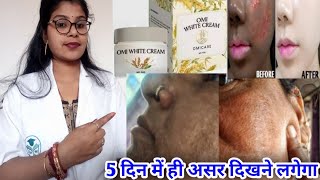 Omi white Skin Cream  Omi white cream honest review Omi white cream benefit uses review in hindi [upl. by Ymmaj339]