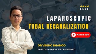 Lap Tubal Recanalization  Under SA BL Pyosalpinx [upl. by Kieger855]