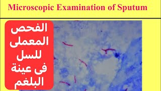 التشخيص المعملى لميكروب السل فحص عينة البلغم Sputum Examination for Diagnosis of TB [upl. by Moe949]